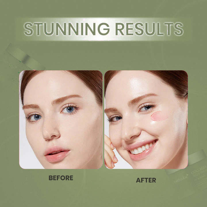 Collagen Niacinamide Jelly Cream