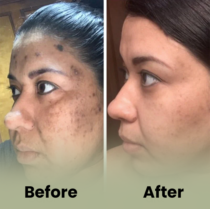 Turmeric and Kojic Acid Pads