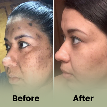 Turmeric and Kojic Acid Pads